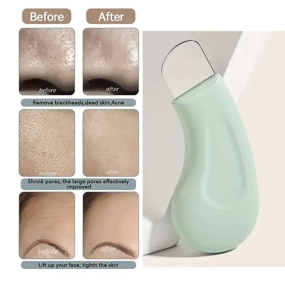 Deep Cleansing Blackhead White - Skincare Routine review and price