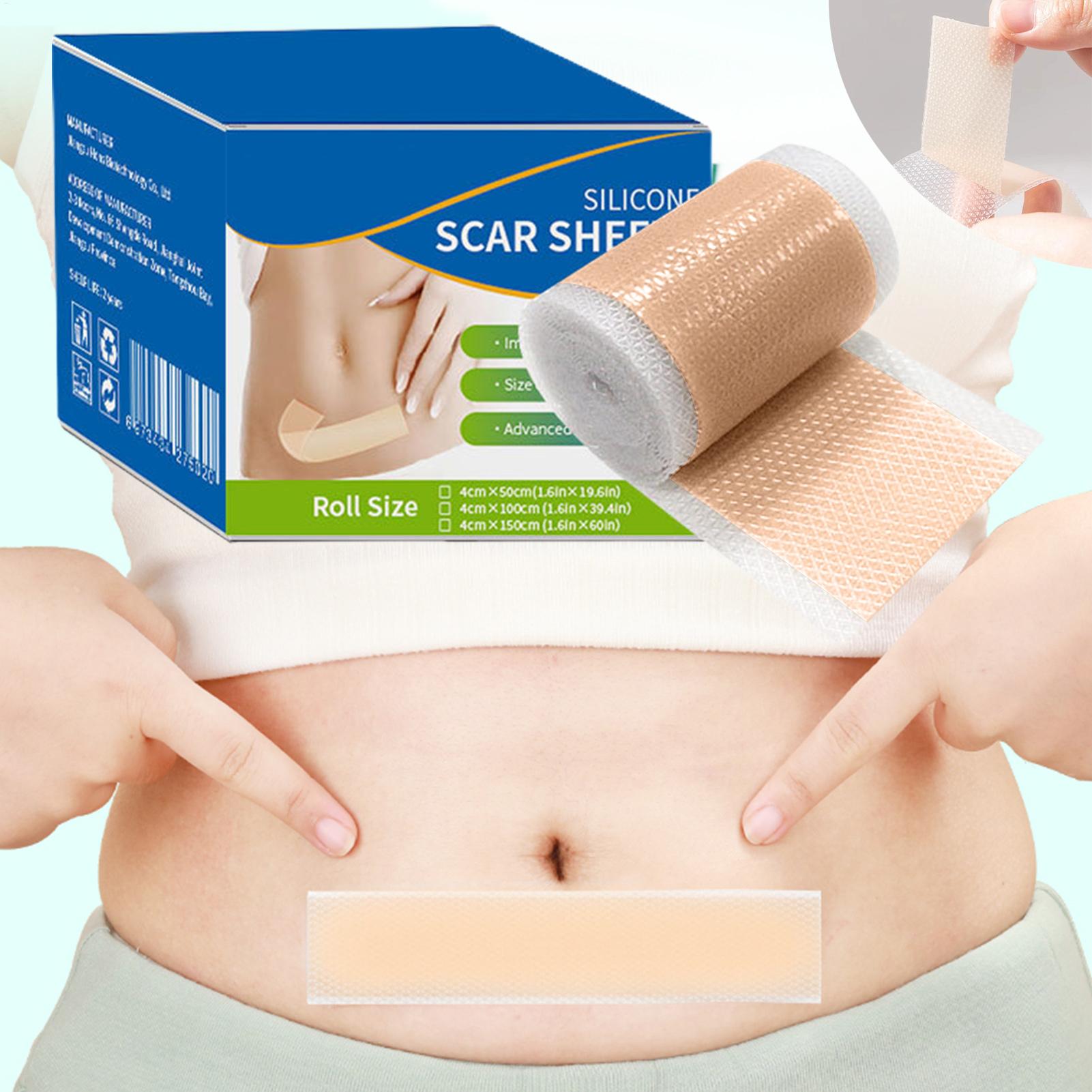 1 Roll Silicone Scar Sheets 4c - Collagen Sheet Mask review and price